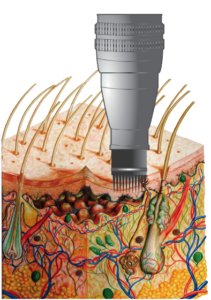 actividerma de jaldun en valencia